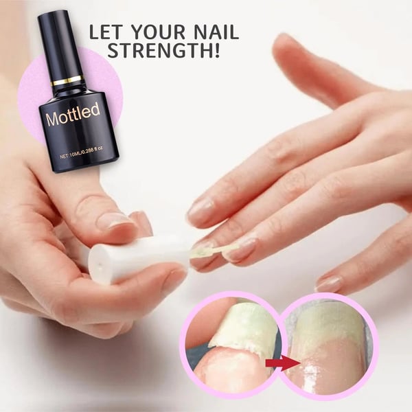 🌟2025 Schutzgel für Nagelreparatur💅 kaufen 2 Holen Sie sich 1 kostenlos