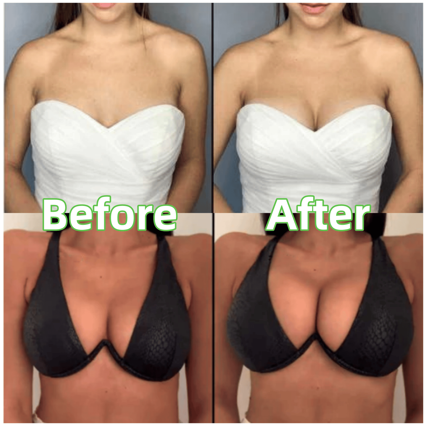⏰ Nur noch heute limitierter Sonderpreis! 🔥 1 kaufen, 1 GRATIS! Ultra Boost selbstklebende unsichtbare Einlagen mit Patentdesign, sofortiger Lift & perfekte Dekolleté-Form für Trägertops, Neckholder und tiefe Ausschnitte ✨