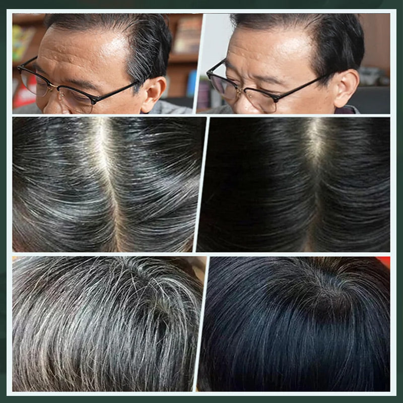 💇‍♀️ KAUFE 1 ERHALTE 1 GRATIS! ✨ Deutsche Pflanzenhaarfarbe für Salon-Perfekte Wurzeln – 100% Pflanzenkraft, Einfache Anwendung & Deckt Graues Haar In 5 Minuten 🌿