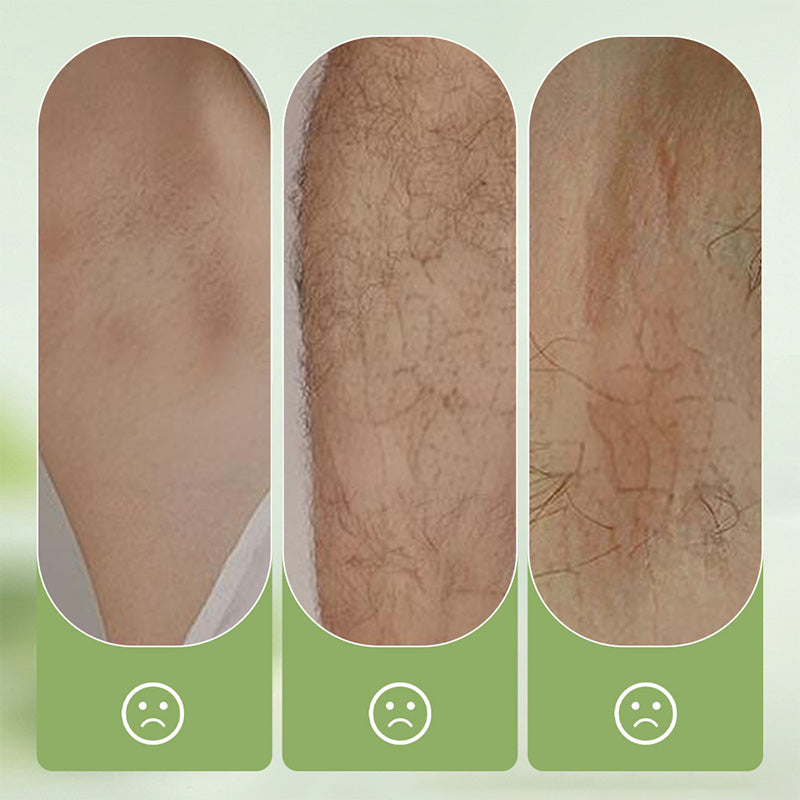 ⏰ Nur noch heute 50% Rabatt! 🪒✨ Sanft hautfreundliches Haarentfernungs-Set (Haarentfernungscreme + Rasierer) – schmerzfreie Anwendung für langanhaltend glatte Haut am ganzen Körper 🎁
