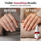 🥳HEISSER SALE 2026🥳💞50.000+ VERKAUFT!👵❤️ 50 % RABATT! 3-in-1 Nagelpflege Reparatur Serum – Aufhellung, Verdickung & Regeneration für beschädigte Nägel