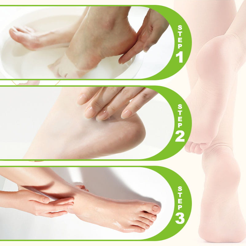 ⏰ Nur noch heute 50% Rabatt! 🦶 Feuchtigkeitsspendende exfolierende Fußcreme mit 60% Harnstoff & 2% Salicylsäure, pflegt rissige trockene Füße mit Aloe Vera, Jojoba- & Avocadoöl ✨